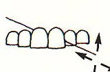 moving floss back and forth